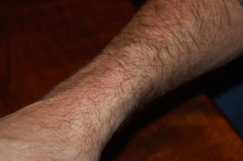 man's hairy arm