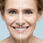 How Long Do Fraxel Results Last? What to Expect Over Time