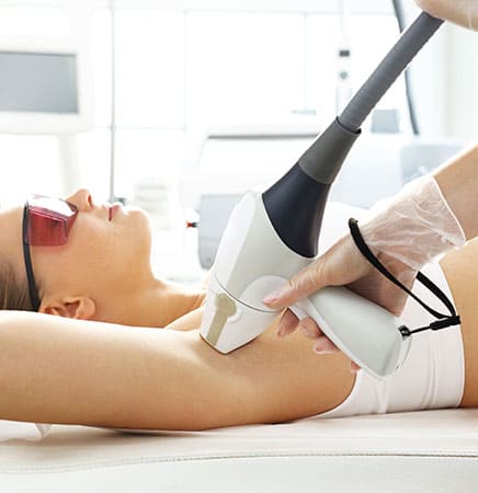 Laser hair removal