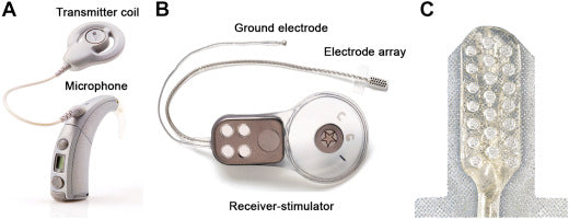 Pediatric Auditory Brainstem Implant Surgery