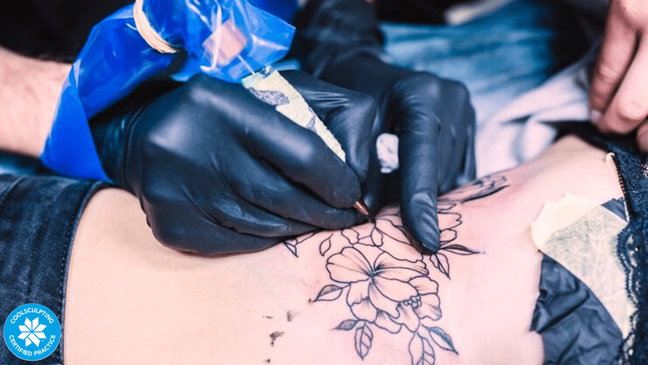 Comprehensive Guide to Hair and Tattoo Removal Services in Regina