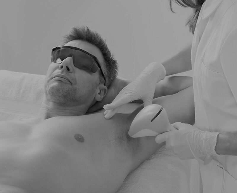 Laser Hair Removal