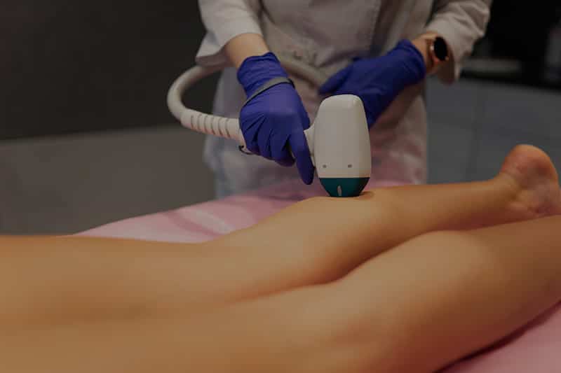 Laser Hair Removal