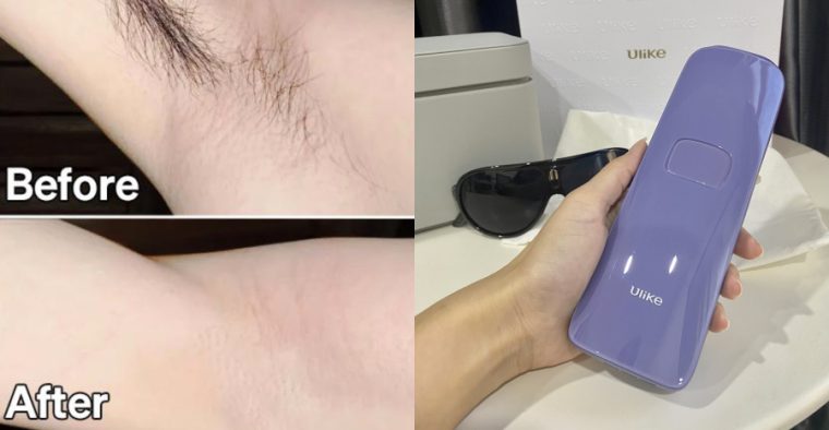 Comparing 5minskin & Ulike: Which Hair Removal Device Reigns Supreme?