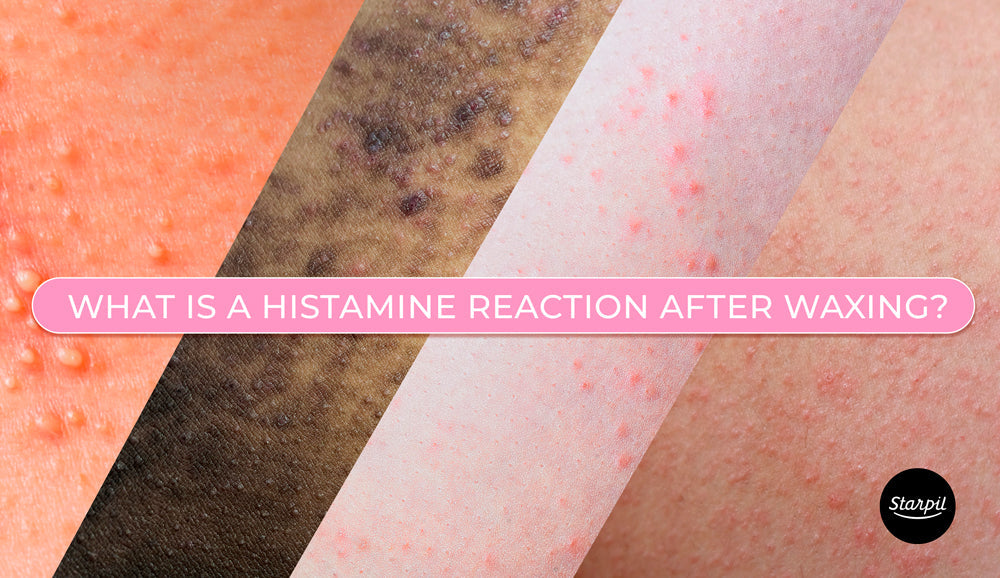 What is a Histamine Reaction After Waxing?