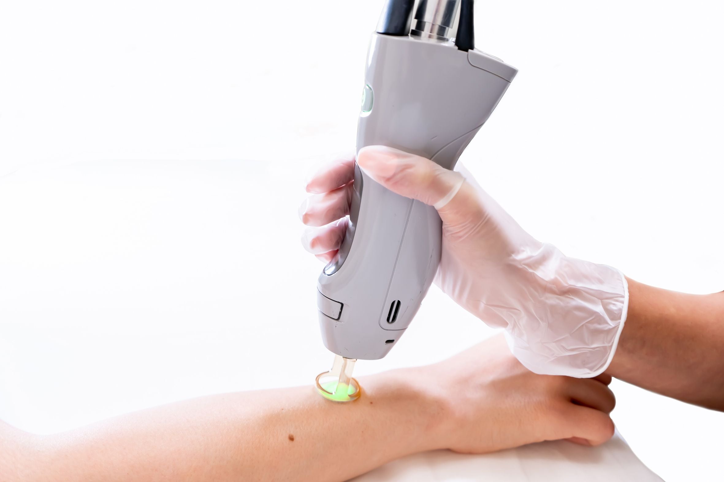 How Much Is Laser Hair Removal At Ideal Image