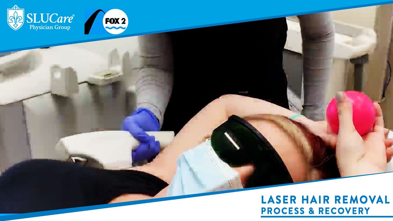 Laser Hair Removal: What Is It, Treatment, Safety And Security & Negative Effects