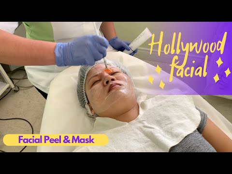 Hollywood Microneedling