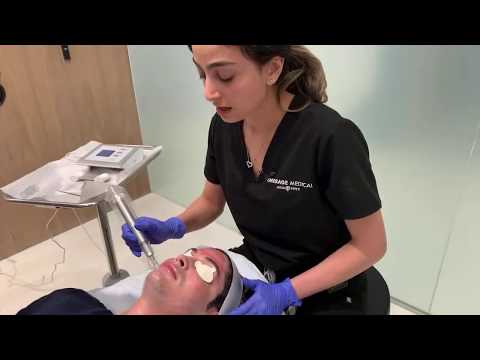 Hollywood Microneedling