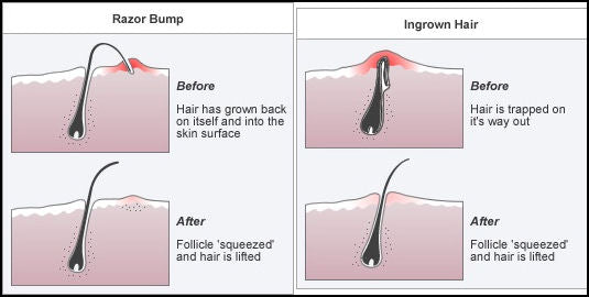 The Facts About Waxing Uncovered