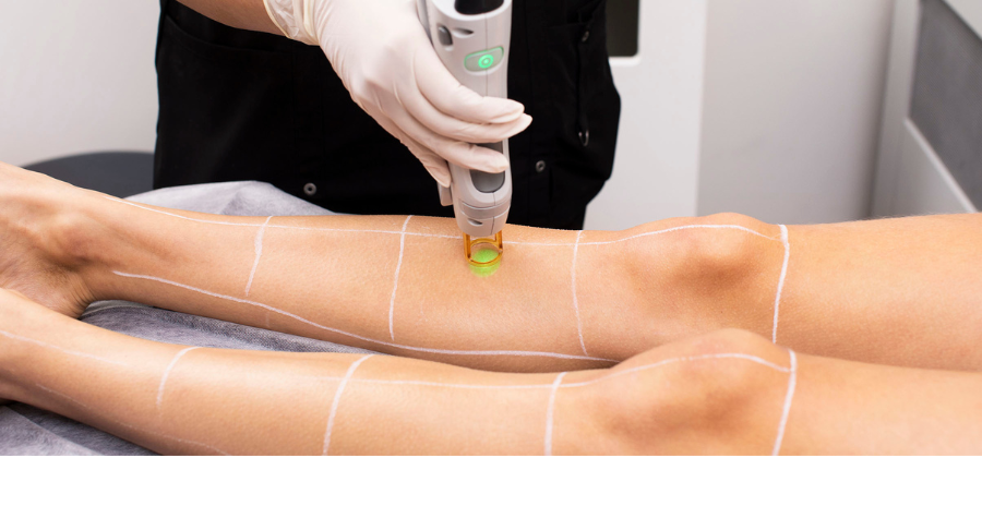 Little Known Facts About Laser Hair Removal Raleigh Nc.