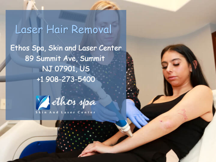 How Permanent is Laser Hair Removal?