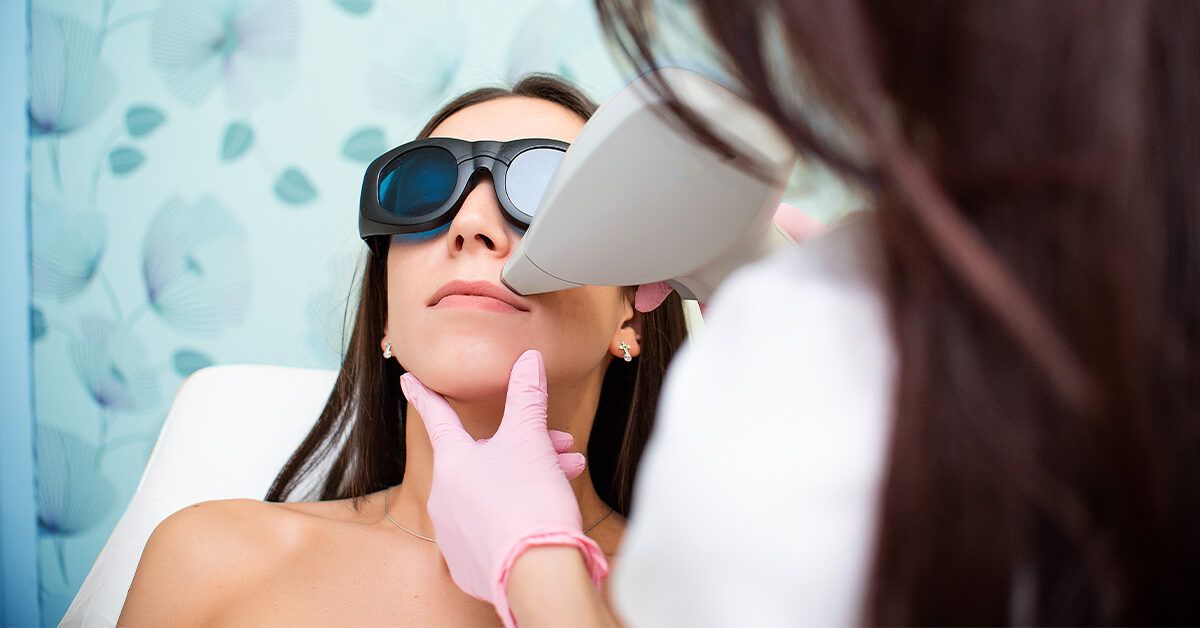 Laser hair removal