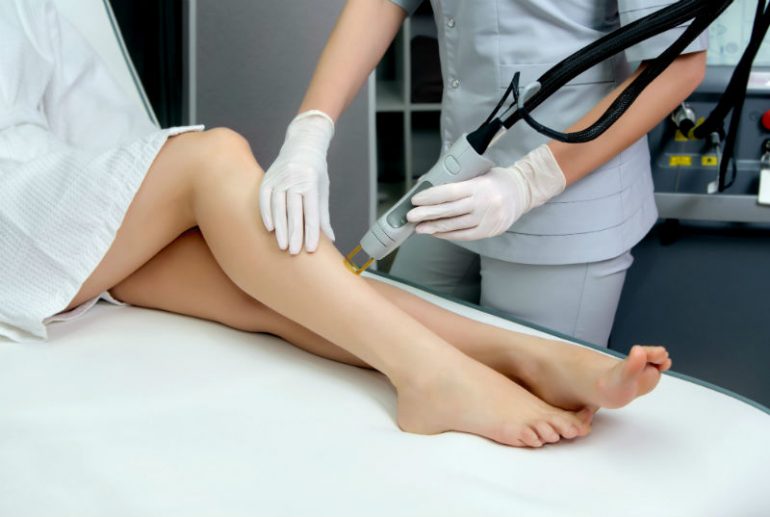 Ideal Image Reviews: Laser Hair Removal Treatment