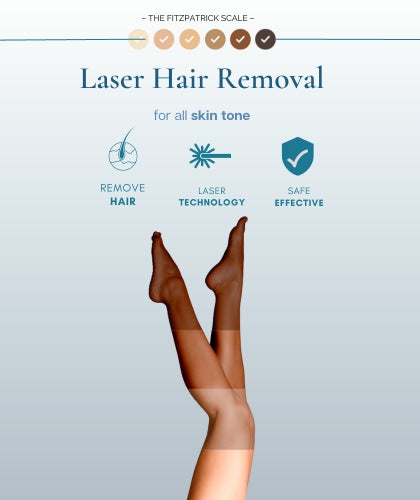 laser hair removal singapore