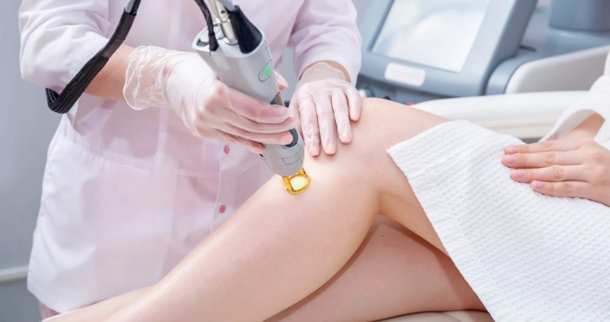 Laser Hair Removal Laser Types