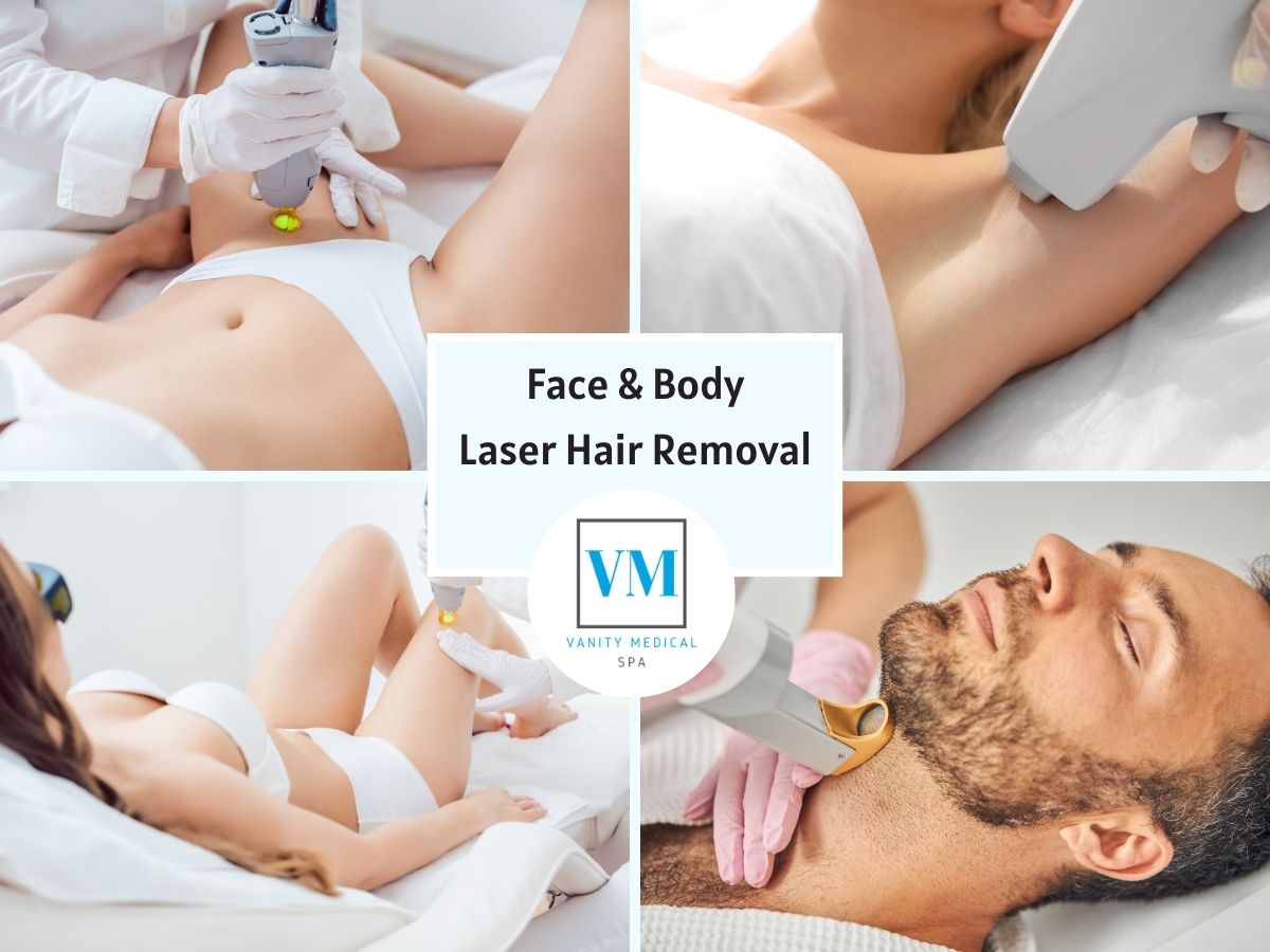 Laser Hair Removal Atlanta