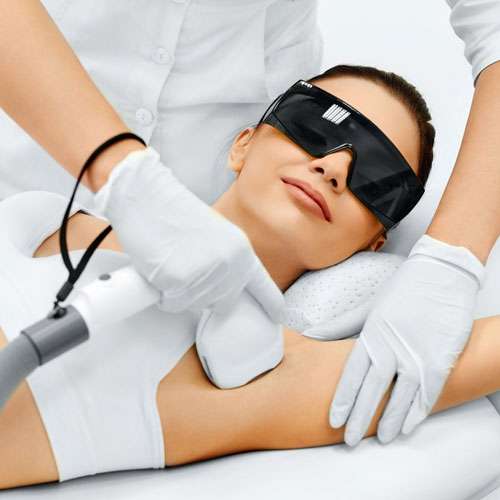 Laser Hair Removal