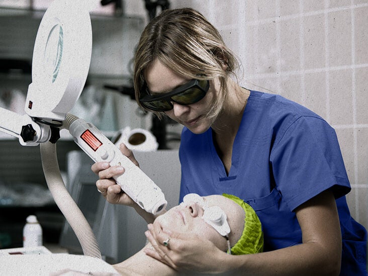 Laser Skin Treatments