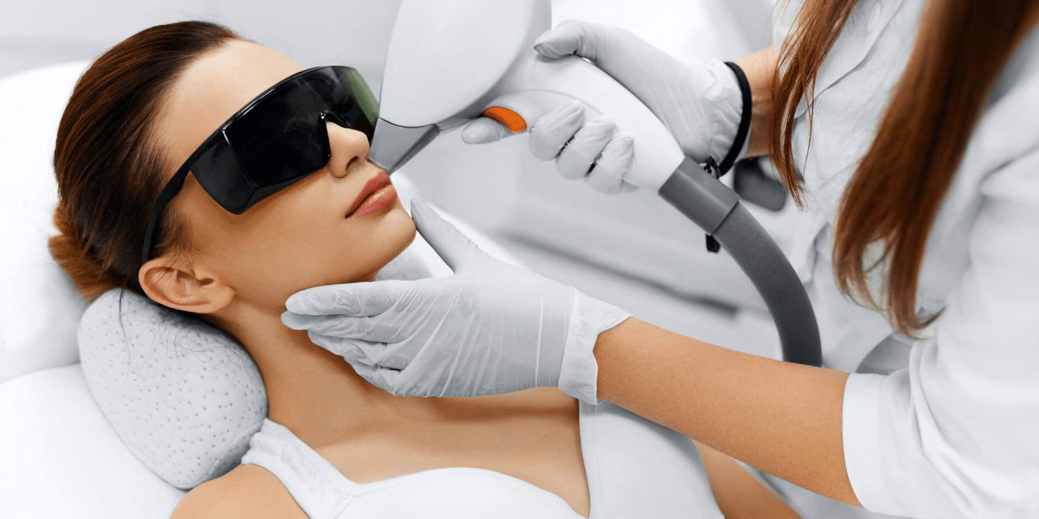 The Insider’s Guide to Laser Skin Treatments