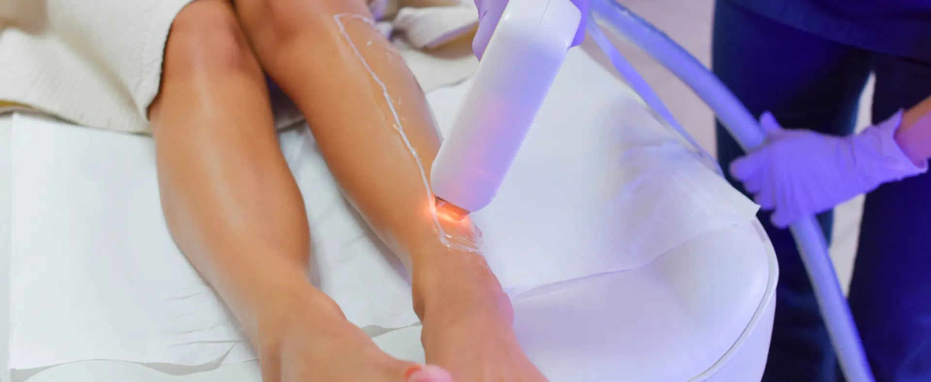 Laser Hair Removal in Texas