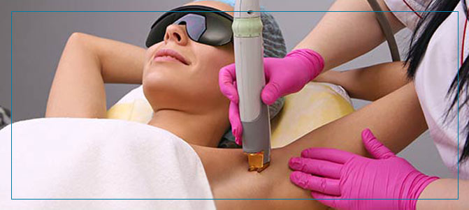 Laser Hair Removal Raleigh NC