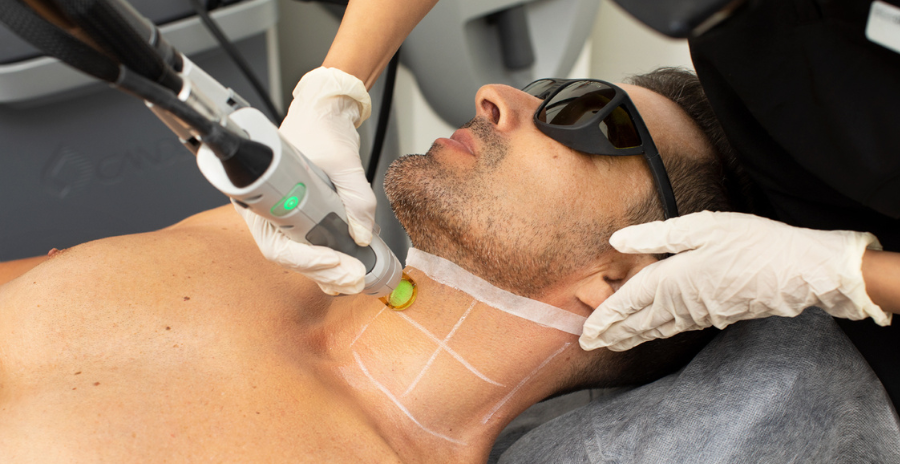 What Does Laser Hair Removal Raleigh Nc Mean?