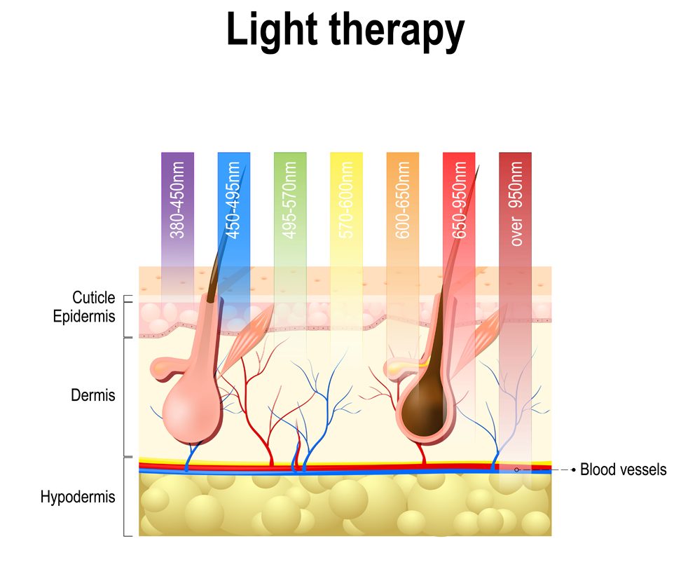 How deep each laser type penetrates the skin. (Photo Credit : Designua/Shutterstock)