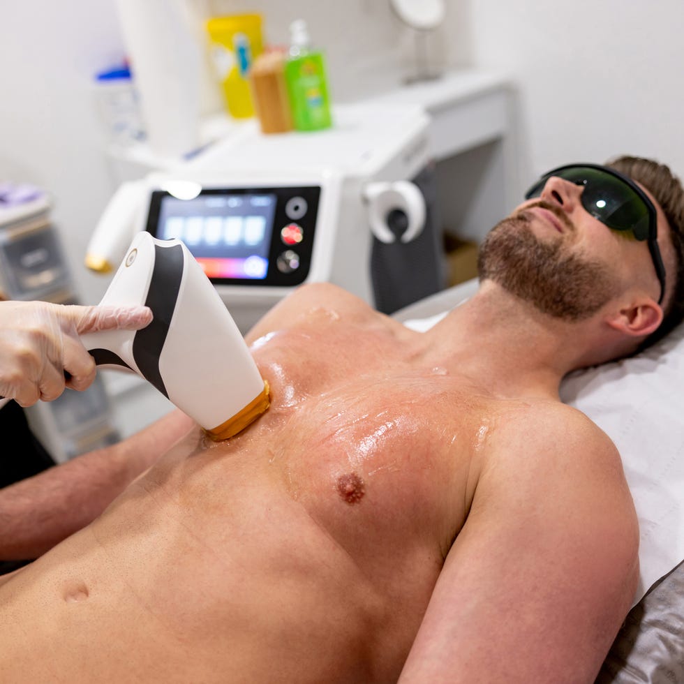 Laser Hair Removal Raleigh NC