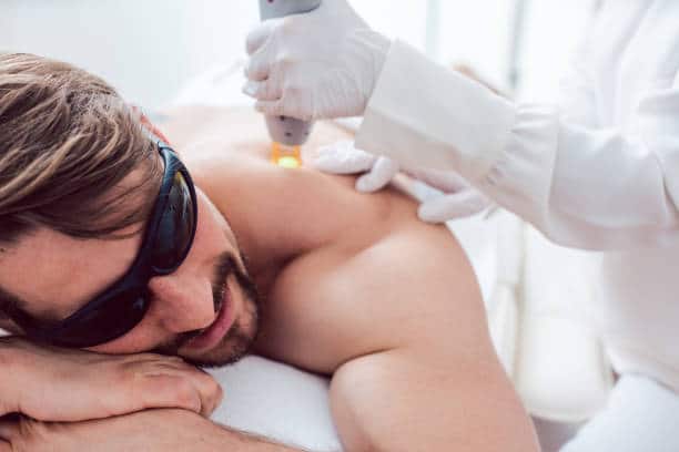 man laying down getting laser hair removal treatment on back and shoulder