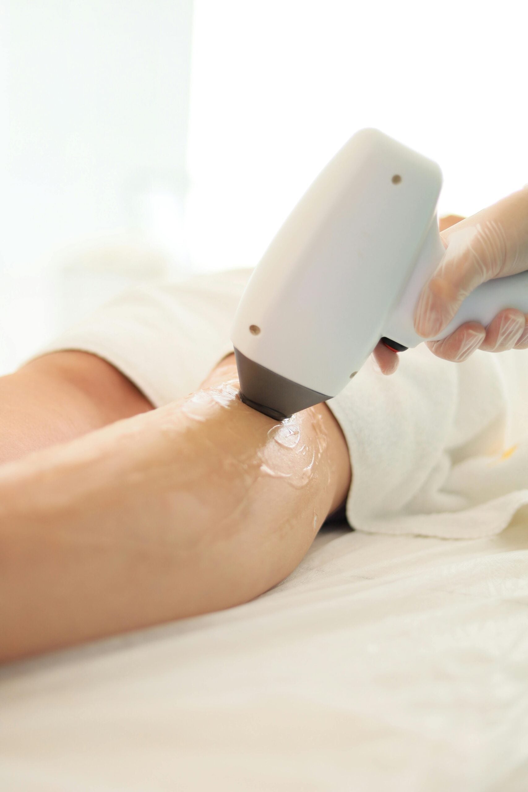 5 Things Moms Should Know About Laser Hair Removal