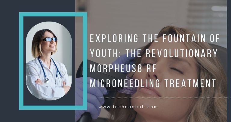 Exploring the Fountain of Youth: The Revolutionary Morpheus8 RF Microneedling Treatment