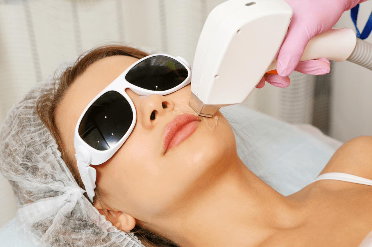 Laser Hair Removal