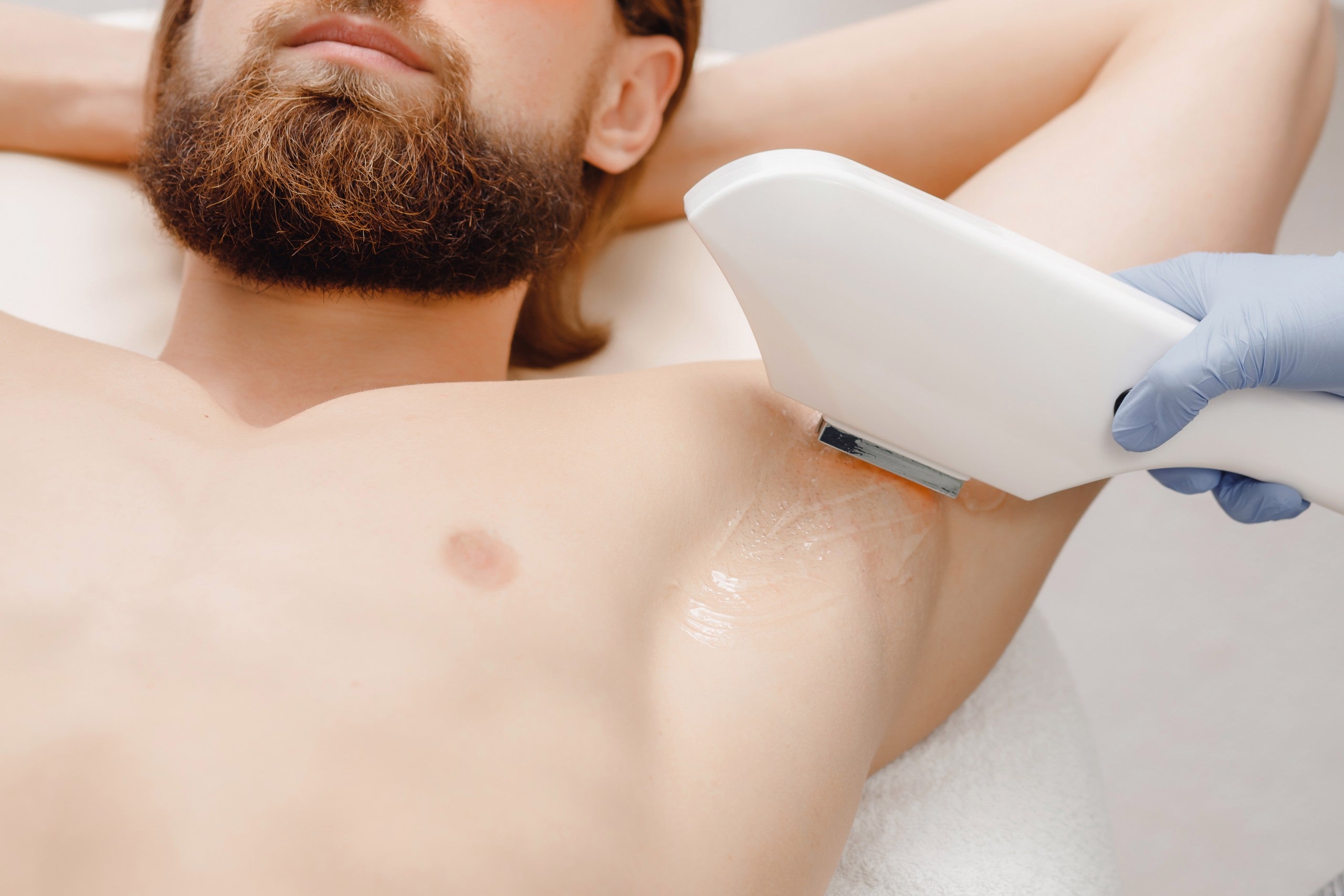 Laser hair removal