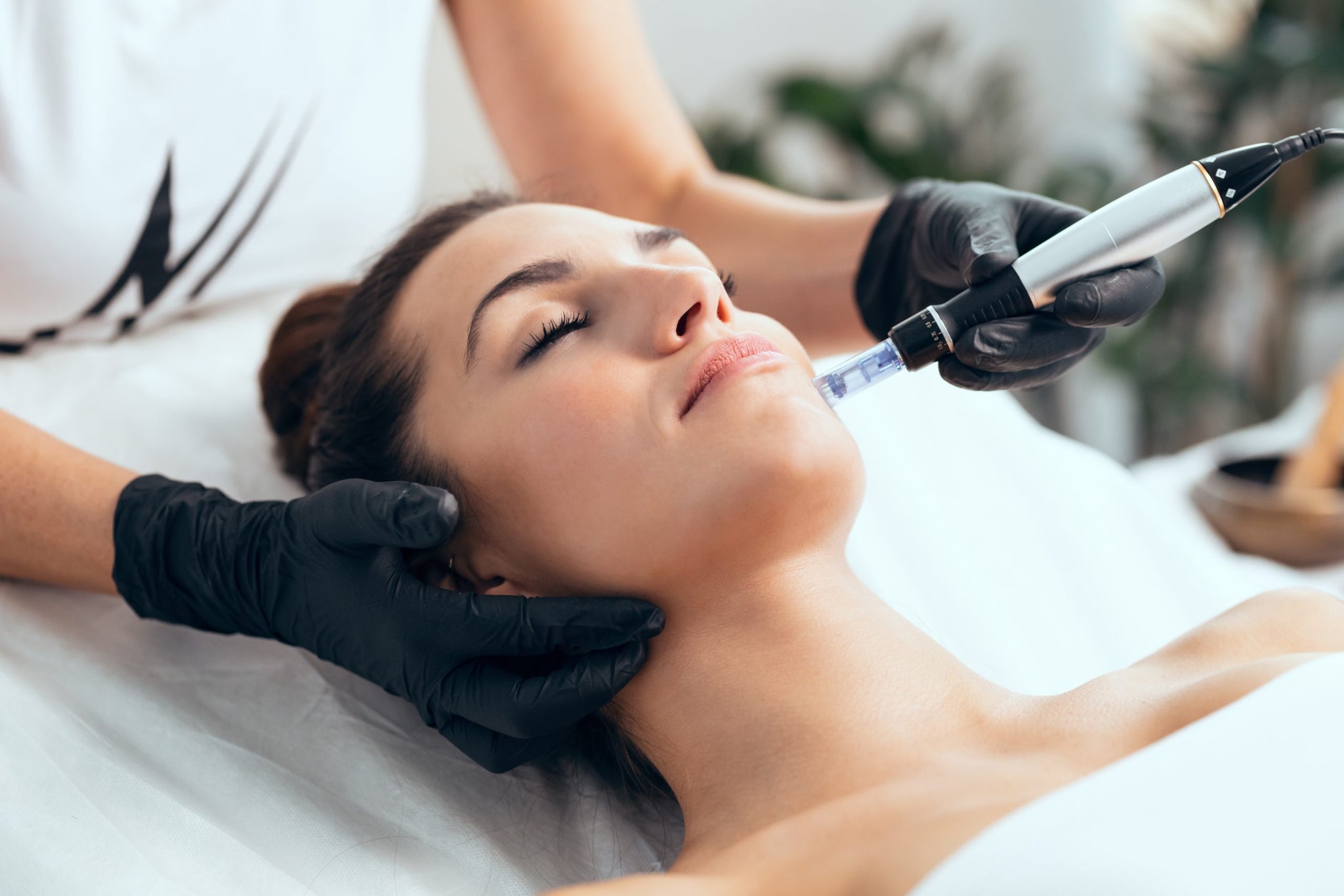 microneedling raleigh nc