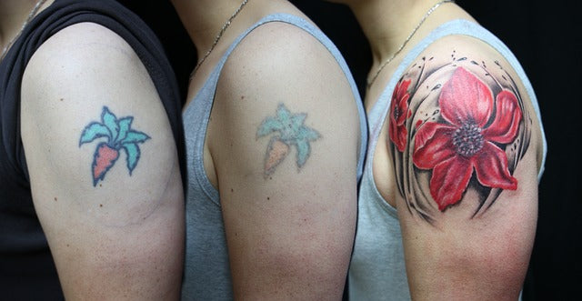 Reasons to Consider Laser Tattoo Removal - hairsmystory.com