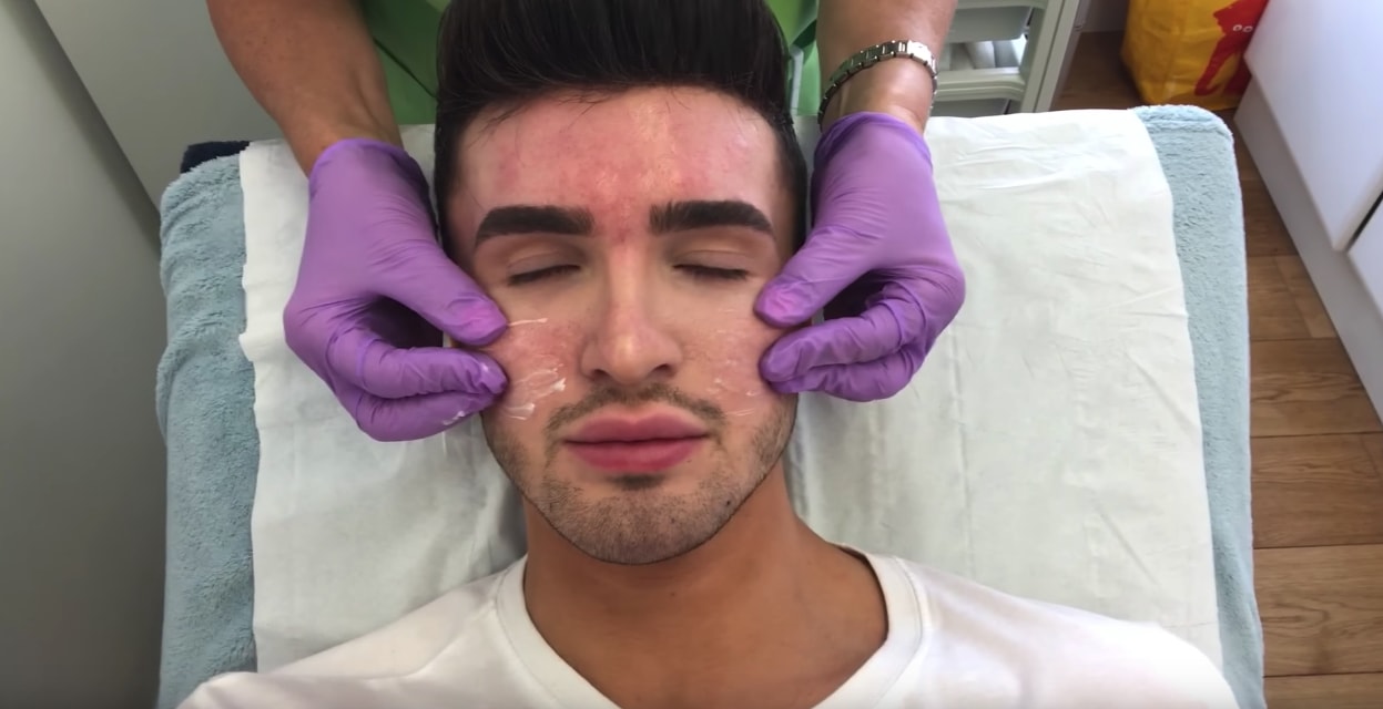 A male getting treatment for botox