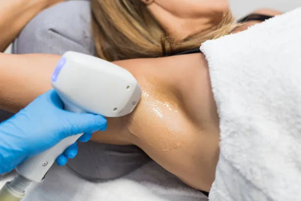 Waxing vs. Shaving: Which is Best for Underarm Hair Removal?