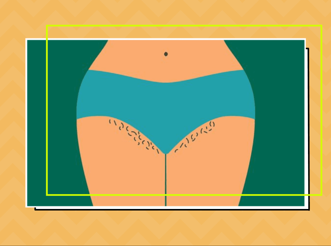 Shaving, Waxing Or Hair Removal Creams? Everything You Need To Know About Pubic Hair Removal