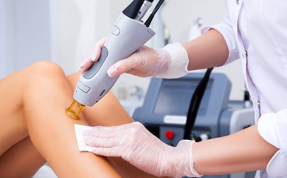 What Are the Benefits Of Doing Laser Hair Removal?