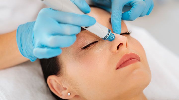 Nashville Chemical Peel