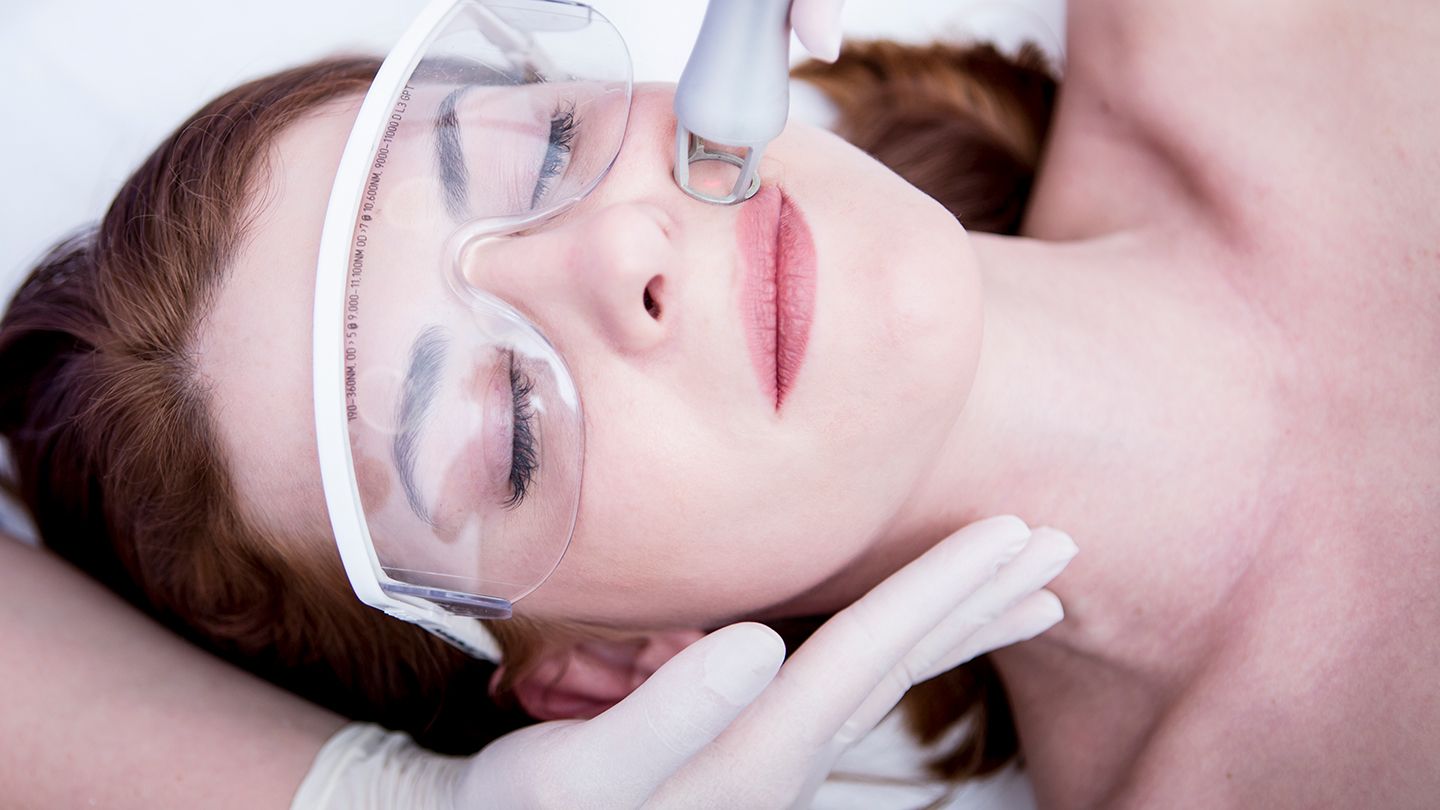 Laser Skin Treatments