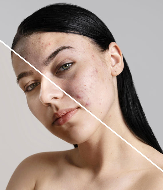 Dermatologist Vs Esthetician: 6 Key Differences And Who To Choose For Healthier Skin - 2